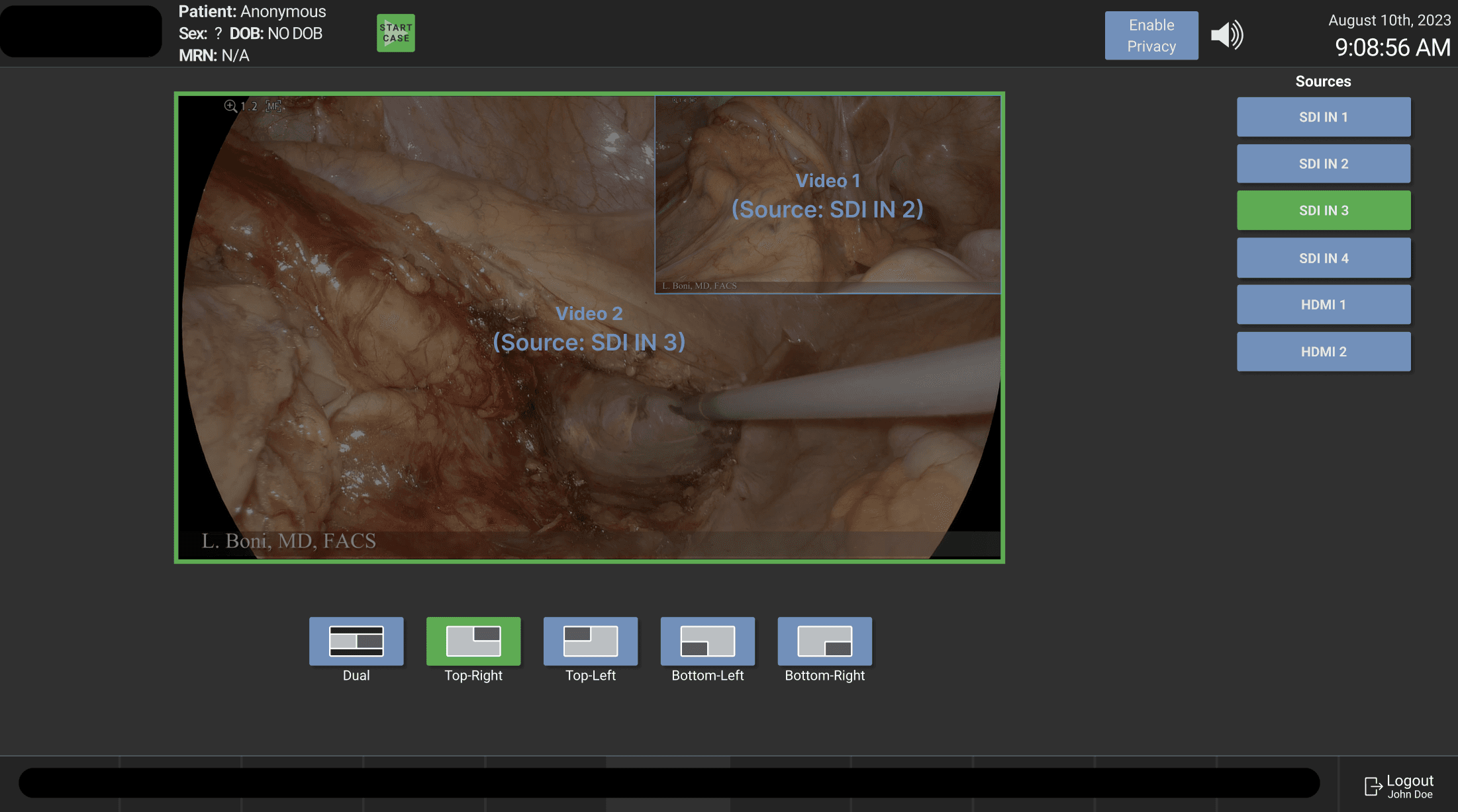HexaVue video-source controls with picture-in-picture layout selection